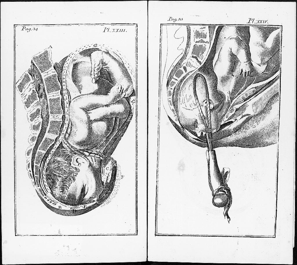 A midwifery handbook, Boston, 1786